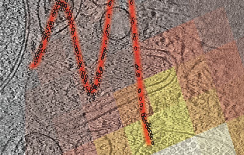 Cryo-ET image 2