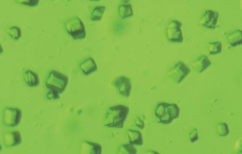 Microscope image of photosystem crystals