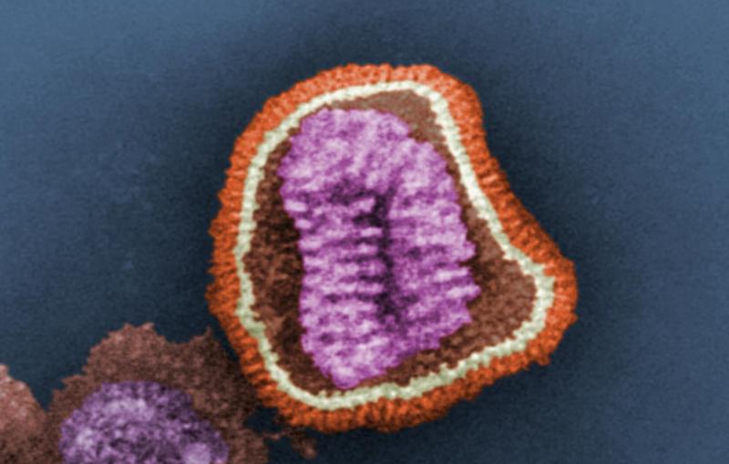 A false color image of an influenza virus particle