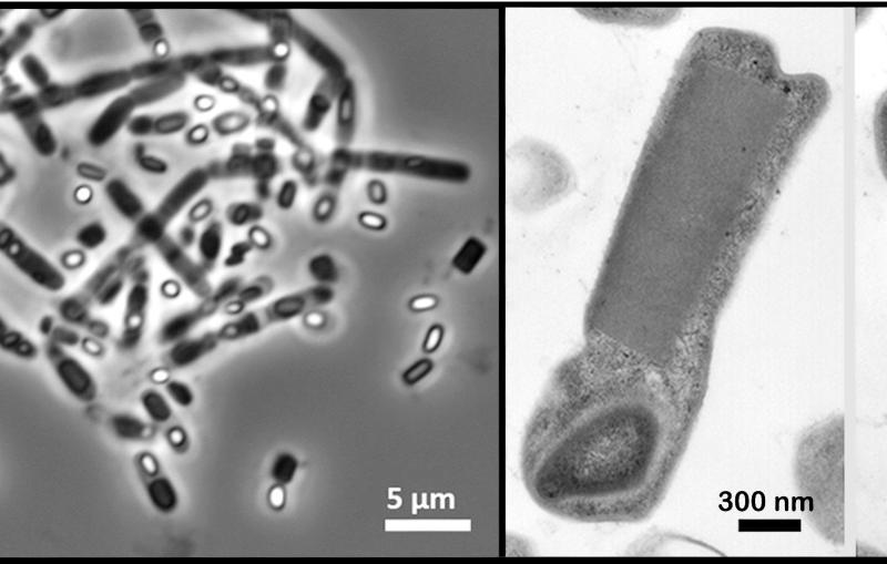 Image - These micrograph images show rod-shaped bacterial cells suspended in pure water. The dark rectangular shapes inside the cells correspond to naturally occurring crystals within the cells.