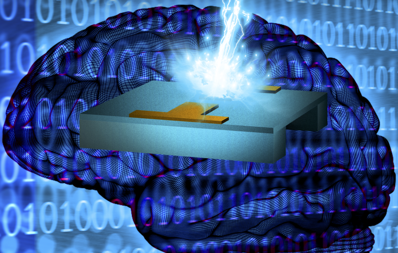 Poster Image: A brain with computing devices around it