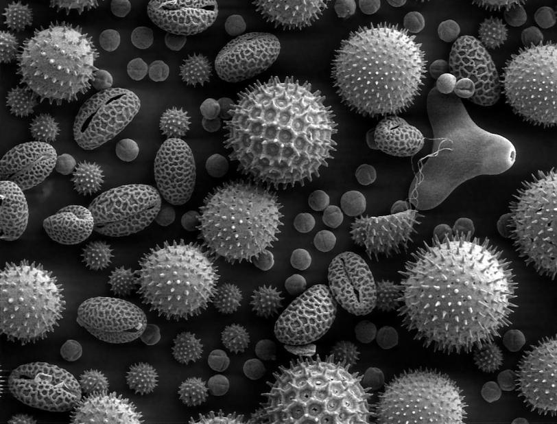 Black and white electron microscope images of pollen.