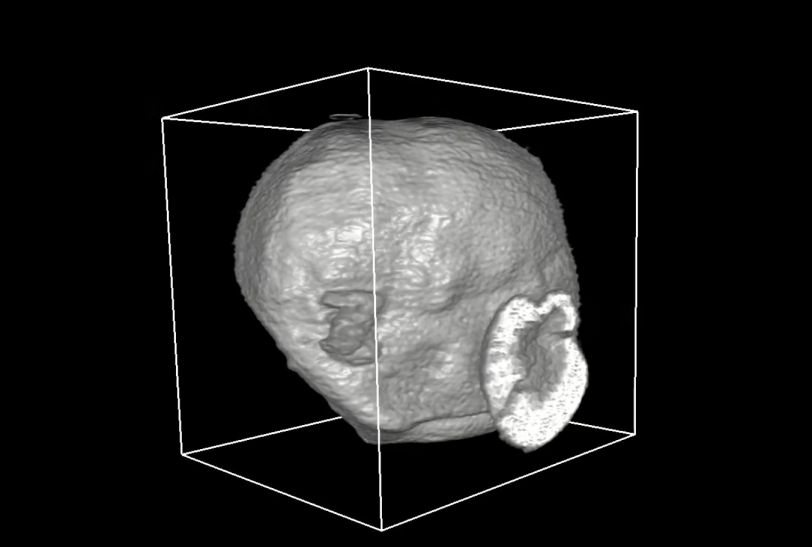 3-D rendering shows a hollow sphere about 10 millionths of a meter across made of a cathode material