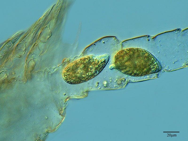 A photo showing single-celled Tetrahymena organisms in the hollow remains of a copepod, magnified 400 times