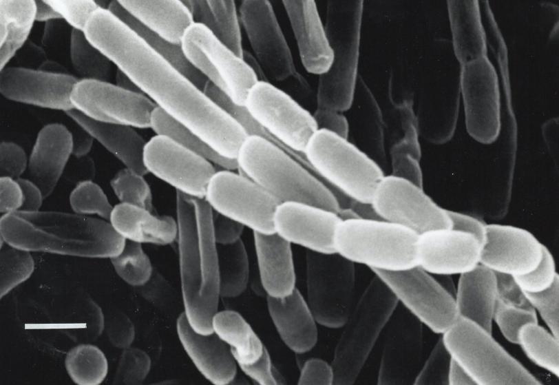 Microscopic black and white image of soil bacteria from Japan that use ECR enzymes to fix carbon super-efficiently