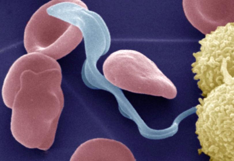 Colored electron micrograph of the bloodstream form of the parasite that causes sleeping sickness