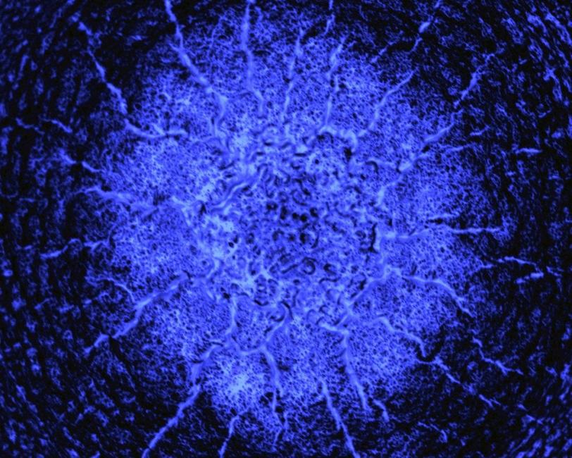 Microscope image of resolidification patterns formed on the surface of silicon after the passage of a shock wave. Scientists at LCLS applied optical laser pulses to launch shocks on various materials on a silicon surface, inducing rapid changes in their l