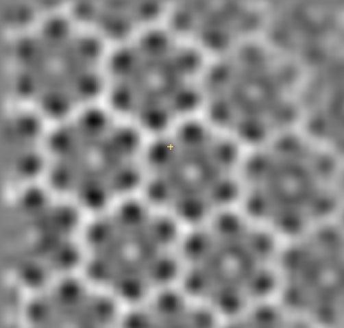 A cryotomographic image of the nanopores and their surrounding proteins