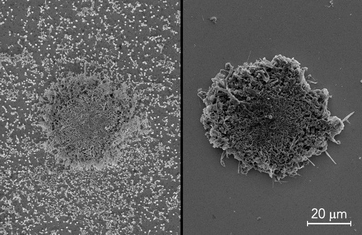 Microscopic images of lithium metal buildup in batteries