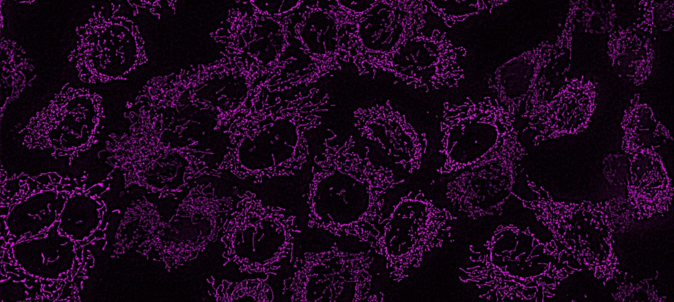 mitochondria_la_final.jpg?h=