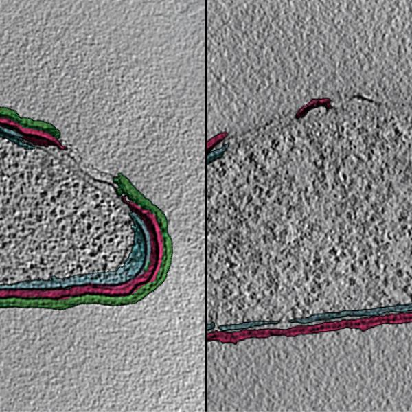 These are two images of the same cell at different times during an experiment. 