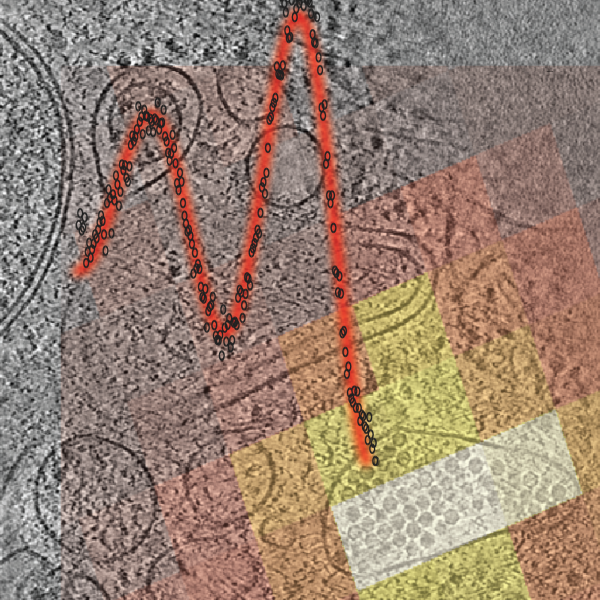 Cryo-ET image 2